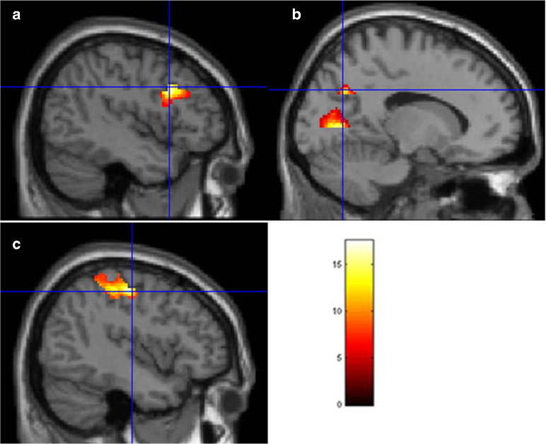 Brain activity images